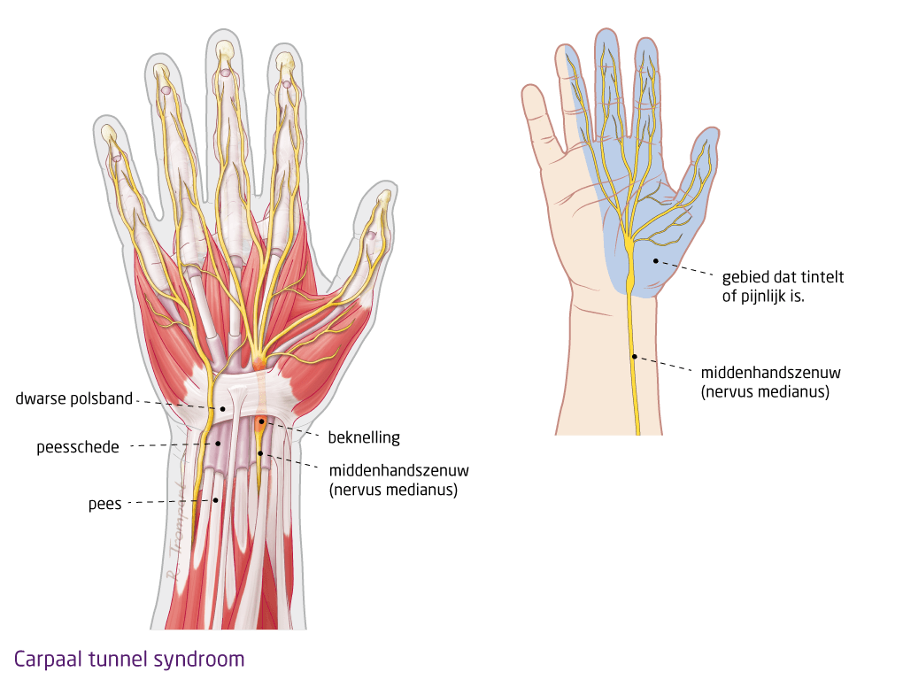 Deze afbeelding heeft een leeg alt-attribuut; de bestandsnaam is vghjkhgchjkjhgf.png